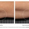 SkinMedica Firm & Tone Lotion for Body - Image 3