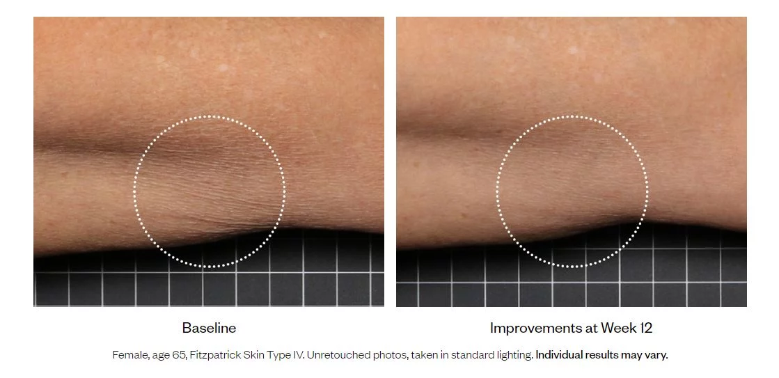SkinMedica Firm & Tone Lotion for Body - Image 3