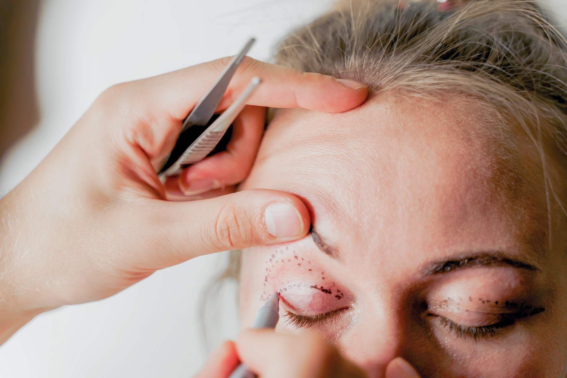 Under-Eye Bags: Best Treatments | Dr. Landis Plastic Surgery