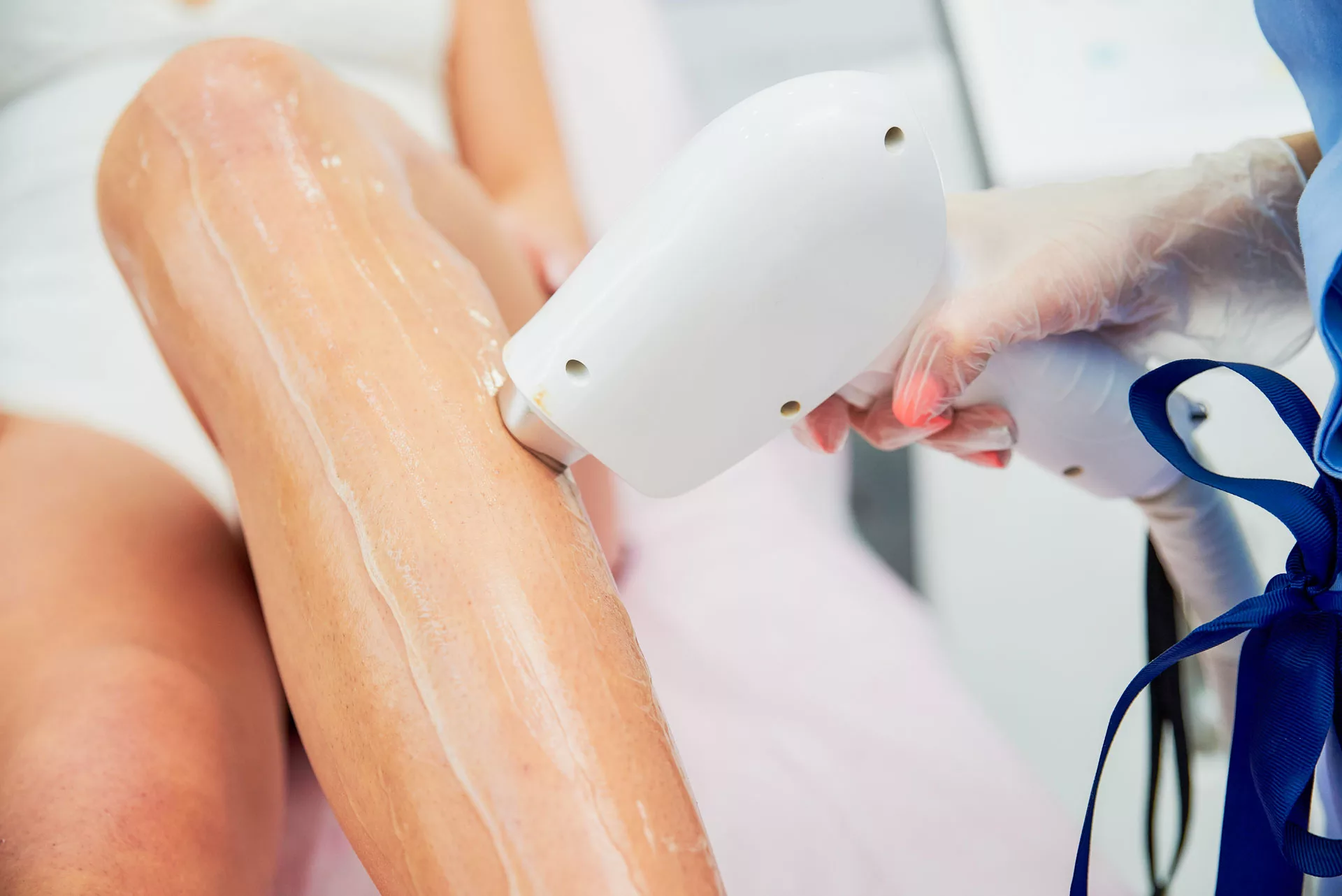 Laser Hair Removal with Soprano ICE at Artemedica