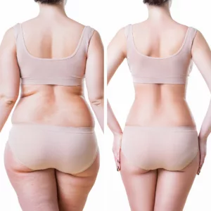 semaglutide shots bonita springs Skinny Shot - Semaglutide Injection