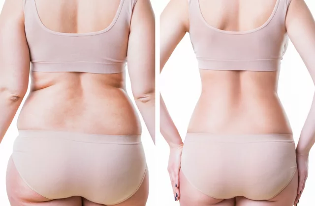 before and after semaglutide injections to lose weight