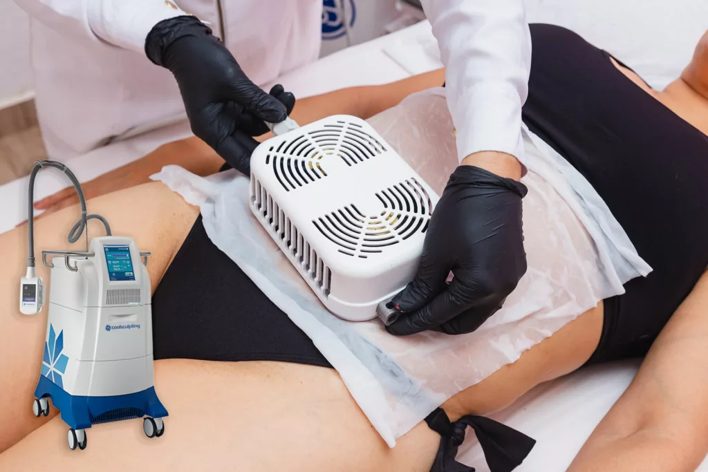 licensed provider applying coolsculpting cryolipolysis applicator to patient's abdomen for body contouring and fat reduction