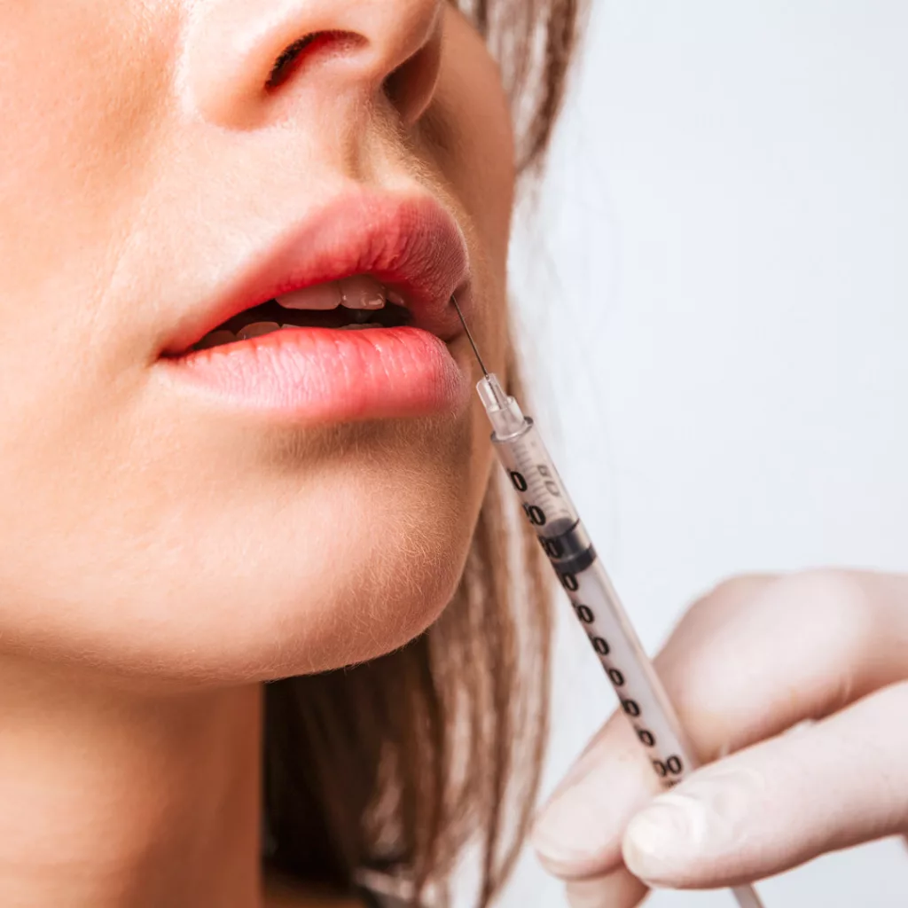 licensed provider injecting cosmetic lip fillers into a woman's lips