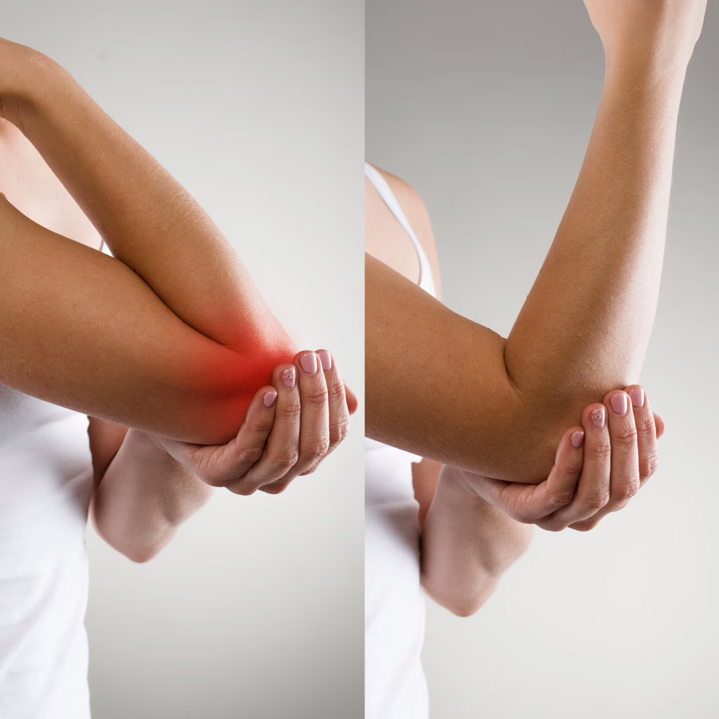 Joint and muscles function before and after EMSCULPT NEO Functional Wellness