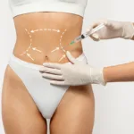 A person receiving skinny shot GLP-1 weight loss injections, against a white background