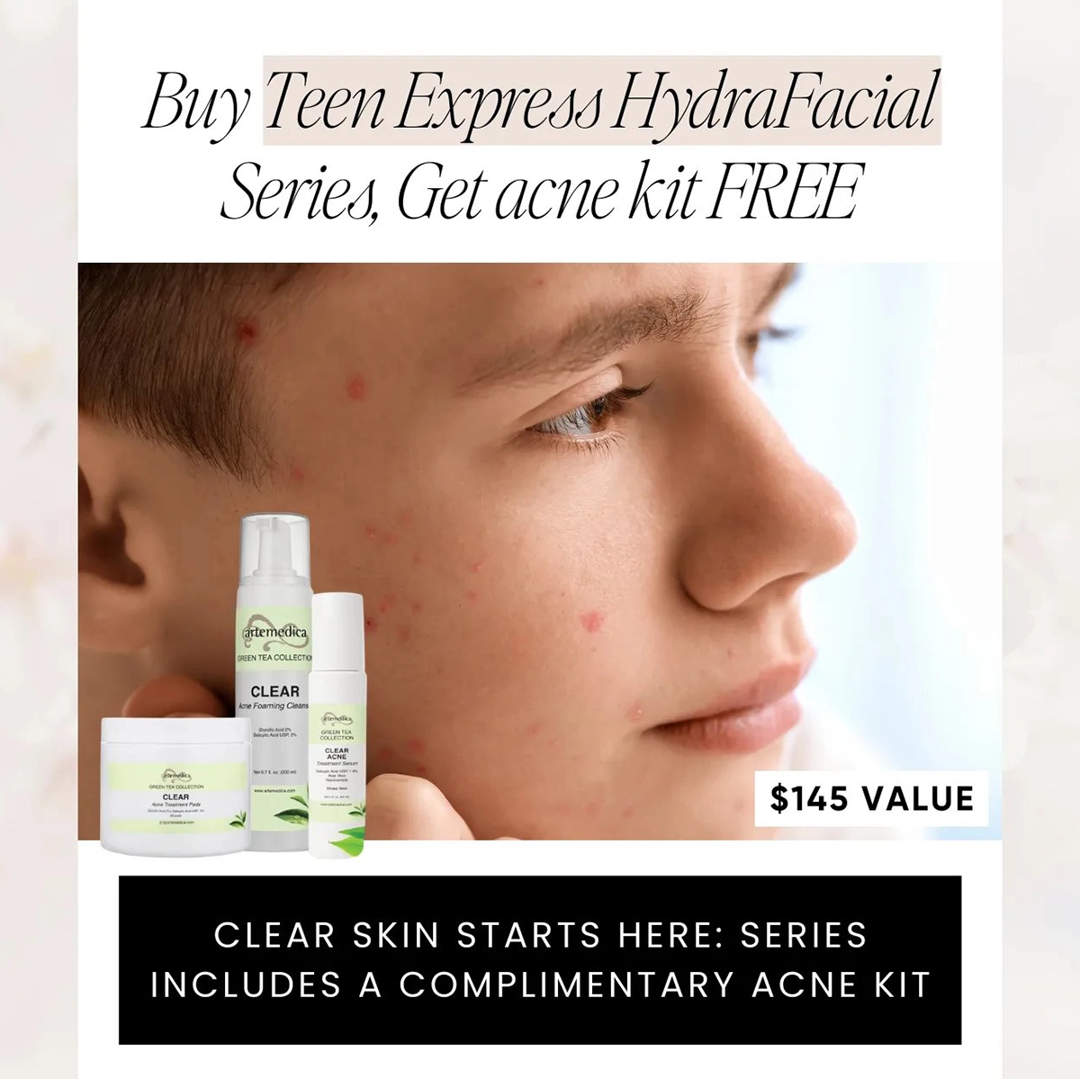 Buy a Teen Express Hydrafacial series to get an acne kit for free!
