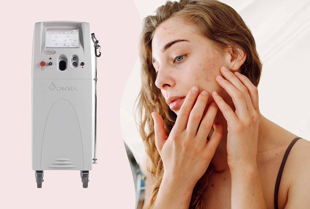 A woman looking at rosacea in a mirror, next to an image of the Vbeam laser machine against a pastel pink background
