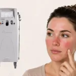 A graphic with a Vbeam laser machine next to a woman touching a finger to her rosacea, showing the concept of Vbeam laser treatments