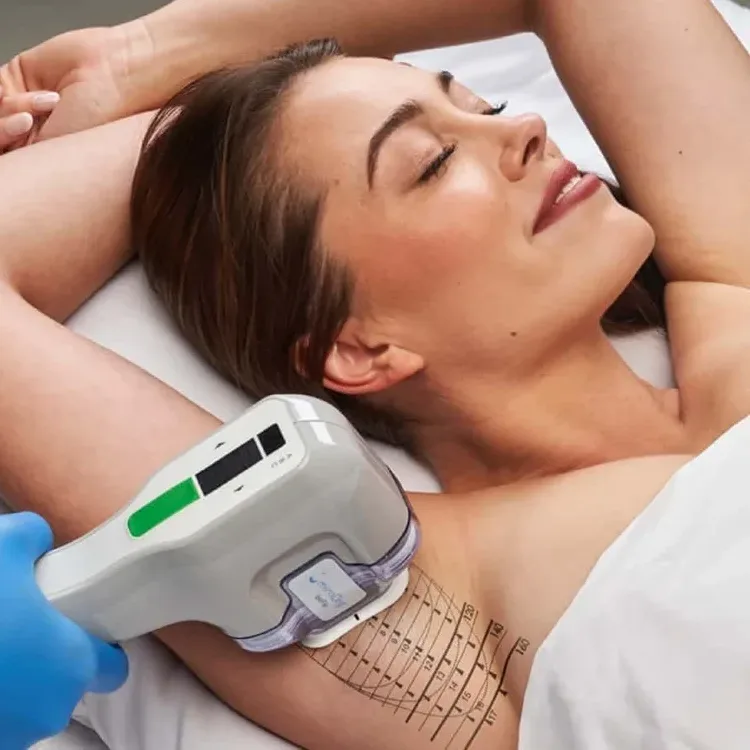 miraDry: the only FDA-approved non-invasive treatment scientifically proven to disable underarm sweat glands for good!