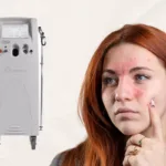 A graphic with a Vbeam laser machine next to a woman touching a finger to her rosacea, showing the concept of Vbeam laser treatments